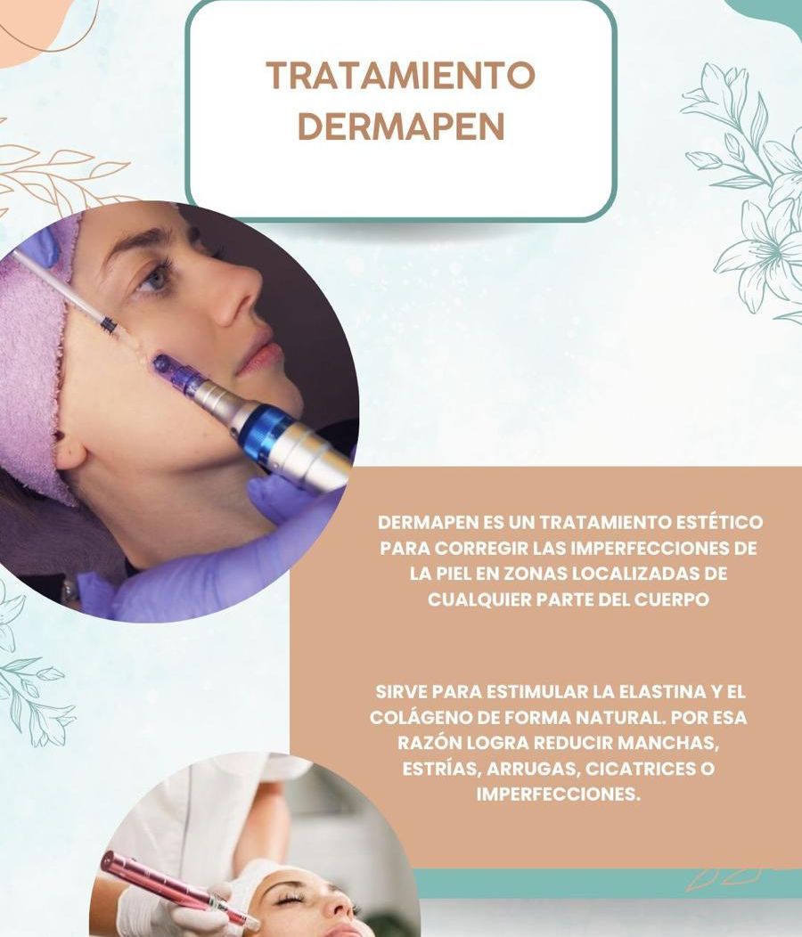 Estetica Ramos tratamiento dermapen