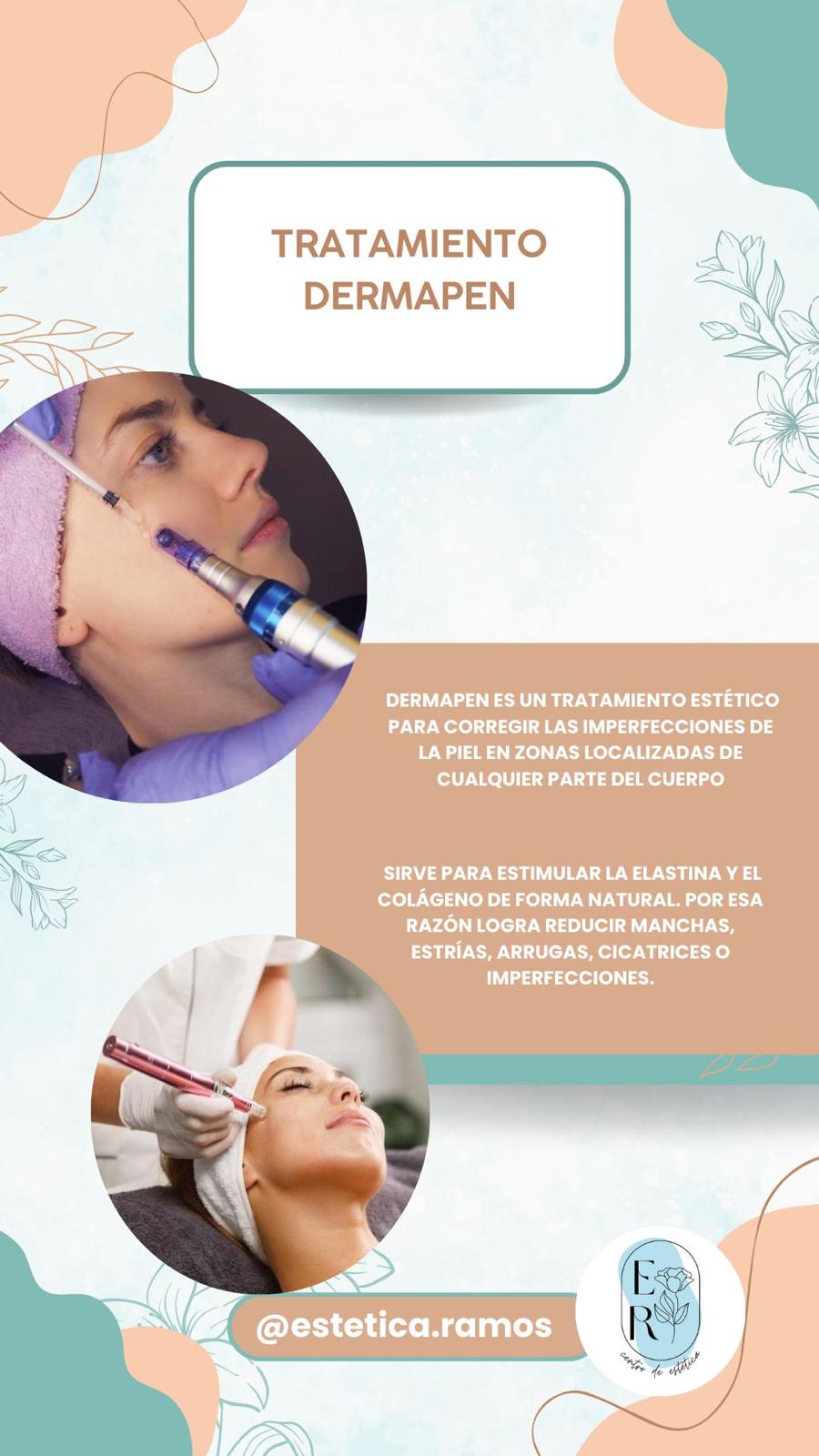 Estetica Ramos tratamiento dermapen